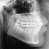 Radiologia Odontológica em Itabuna